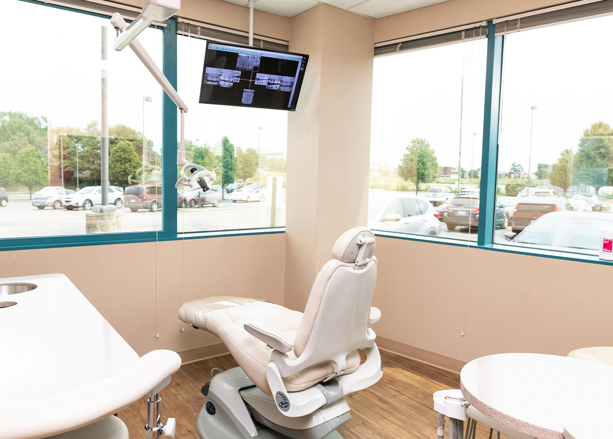 dental fillings